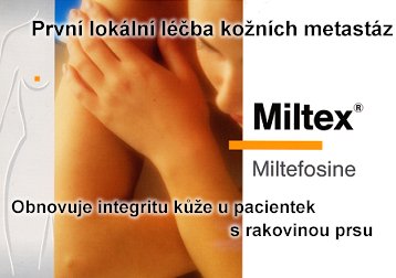 Miltex - první lokální léčba kožních metastáz